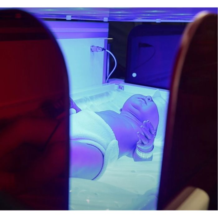 Пристрій неонатальний для кругової фототерапії НО-АФ-LED3