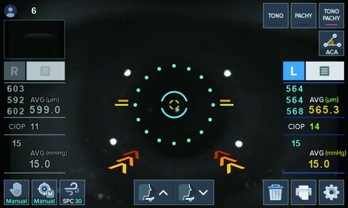 Пневмотонометр безконтактний HNT-1